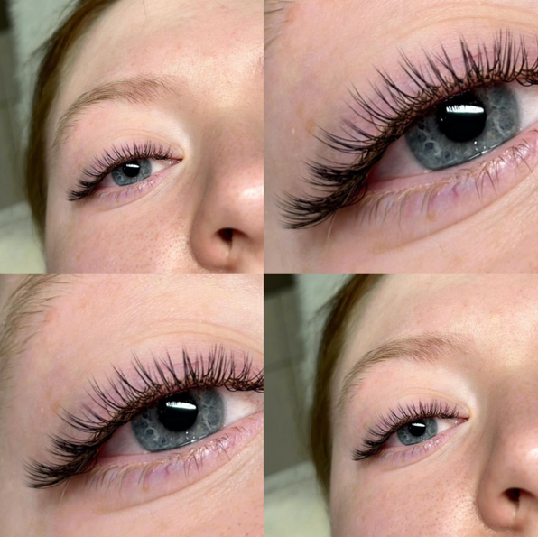 1D - классическое наращивание