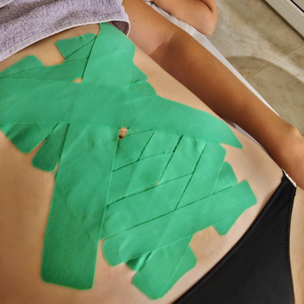 ДИАСТАЗ тейпирование