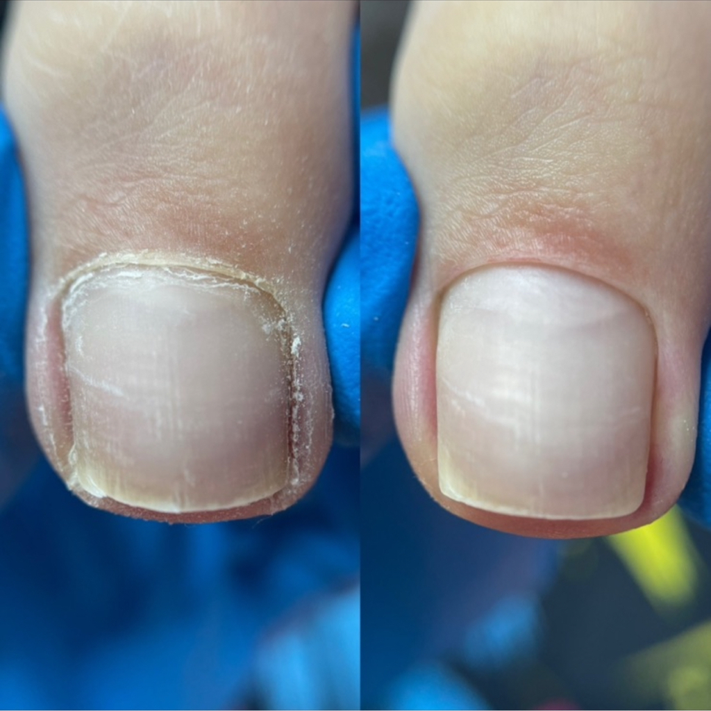 Педикюр без покрытия (пальчики и стопа)