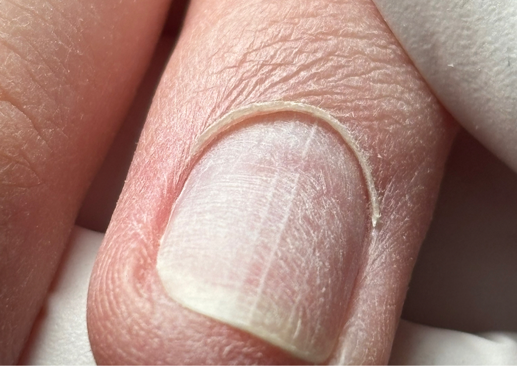 Комби маникюр + снятие покрытия