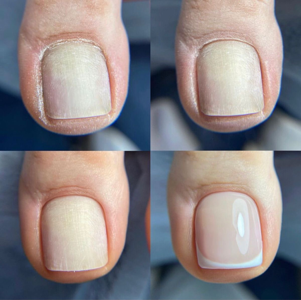 обработка пальчиков ног + гель-лак