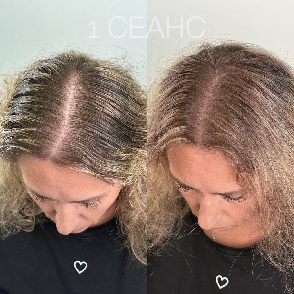 Загущение редких волос у женщин