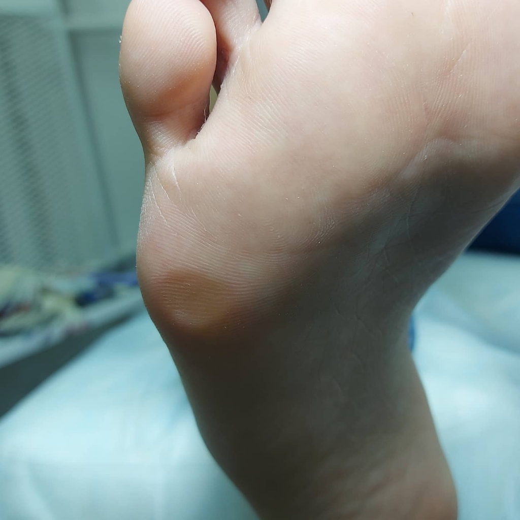 Обработка стоп