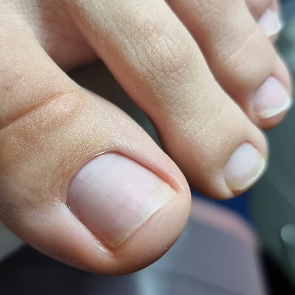 Обработка пальцев (без покрытия)