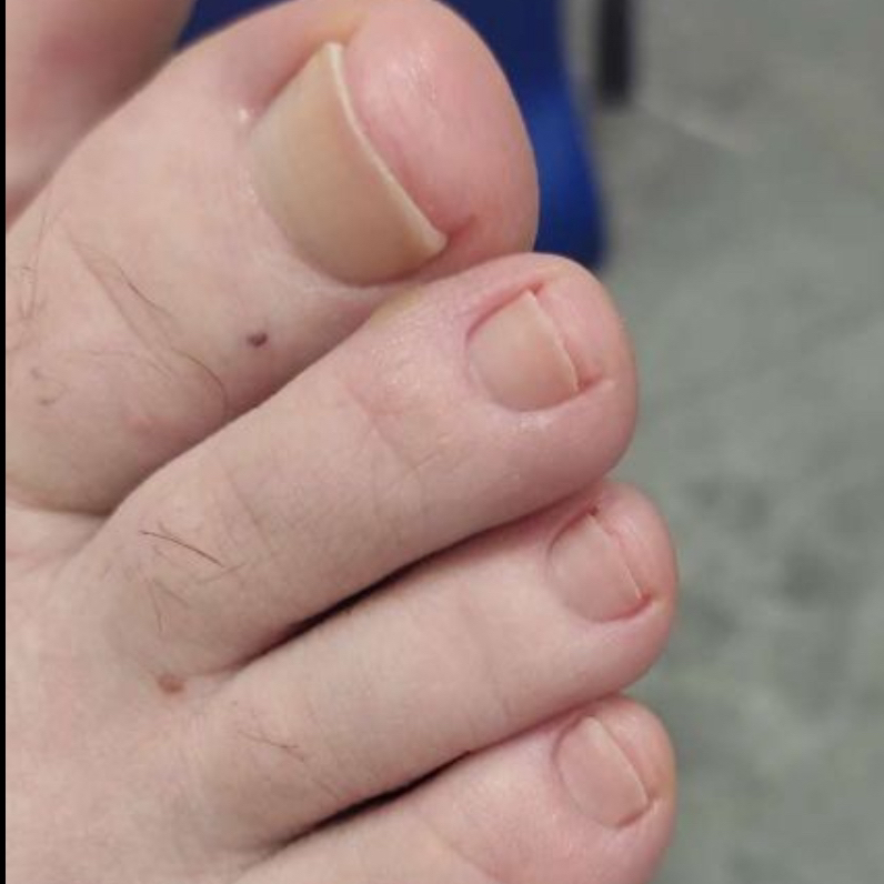 Гигиенический педикюр