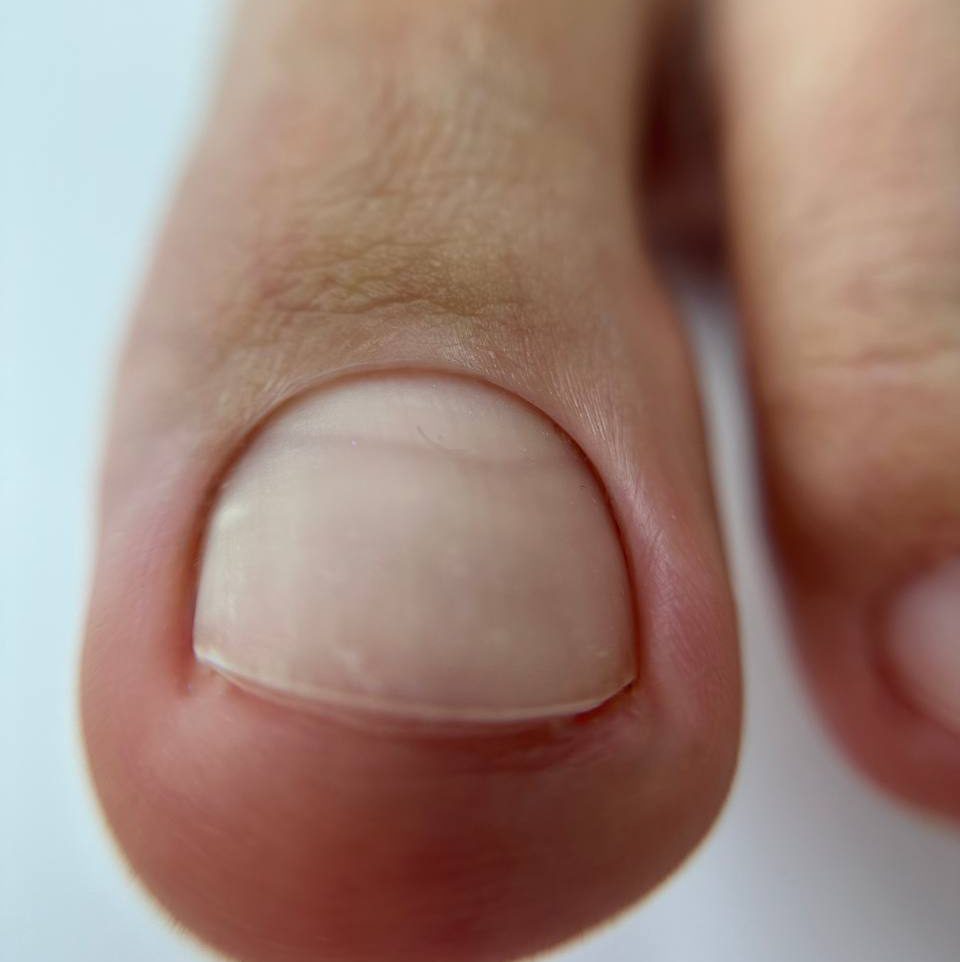 Smart без покрытия