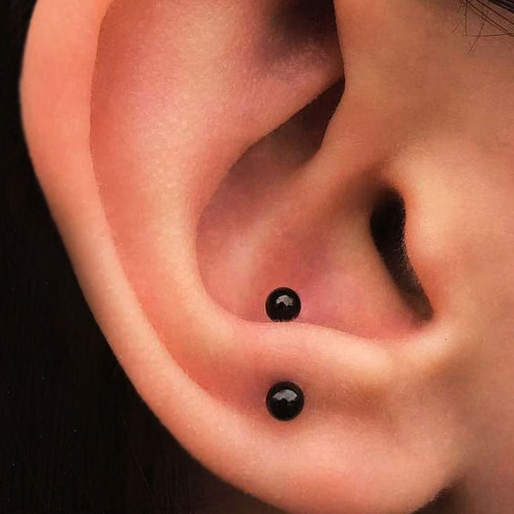 Анти трагус