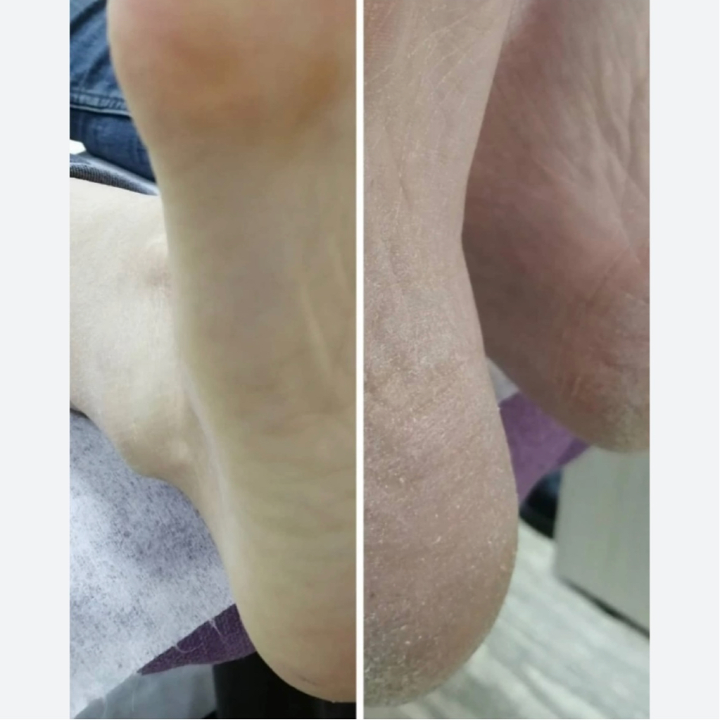 Педикюр с обработкой стопы (без покрытия)