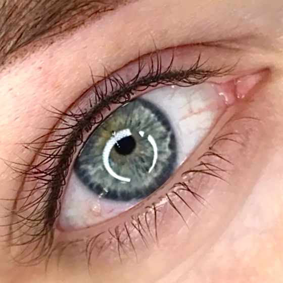 межресничка второй этап (коррекция)