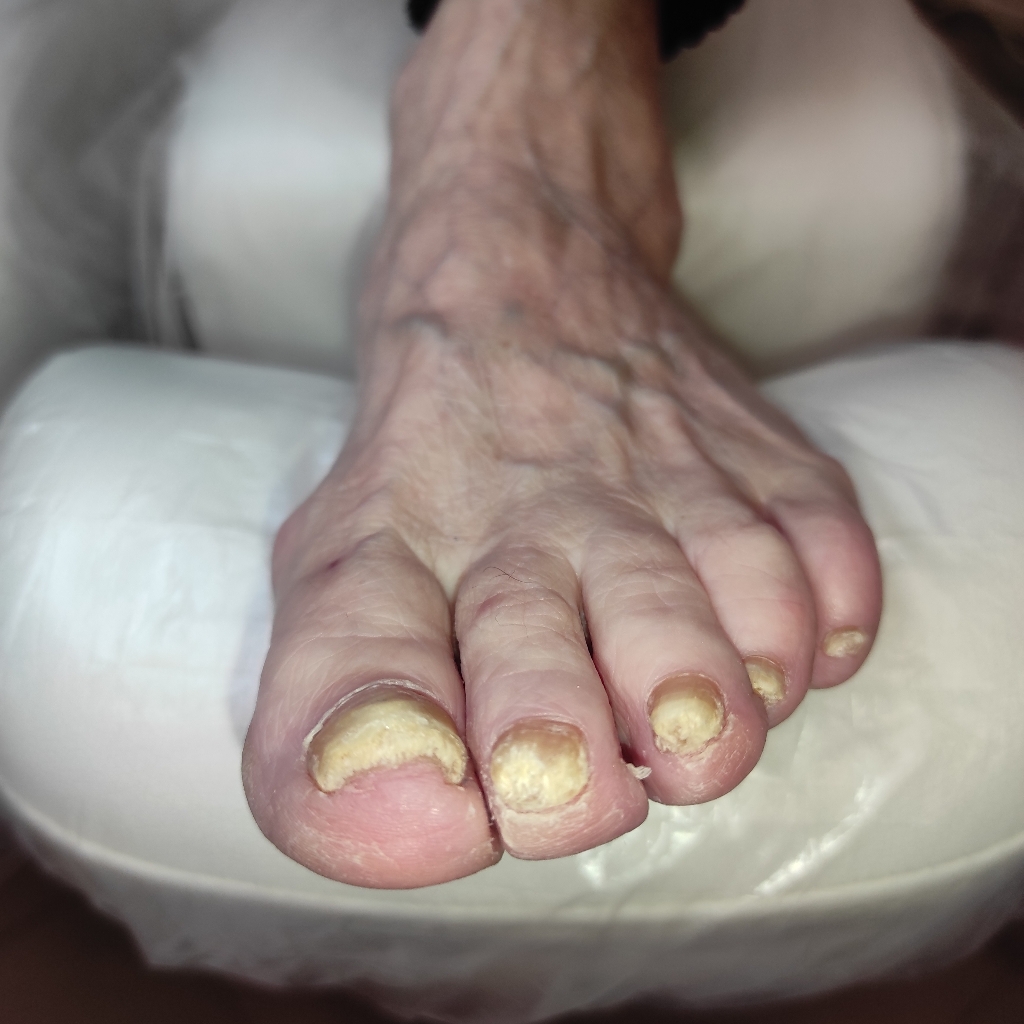 Подологический аппаратно-препаратный педикюр без покрытия