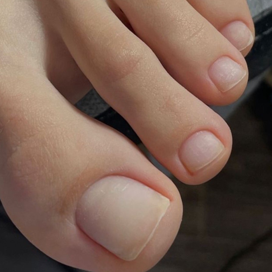 Обработка пальчики без покрытия.