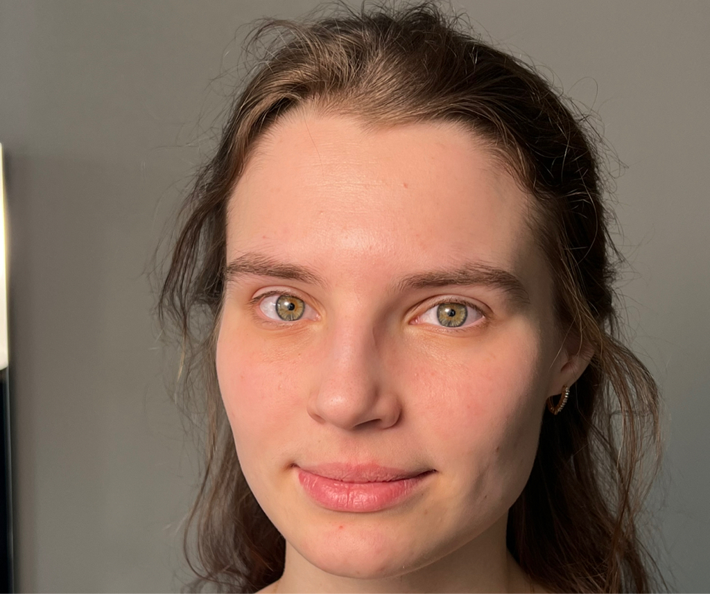 Коррекция формы