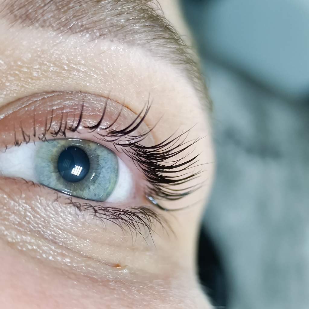 Итальянское восстановление + ботокс