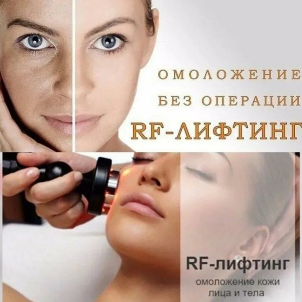 RF лифтинг лица+шеи