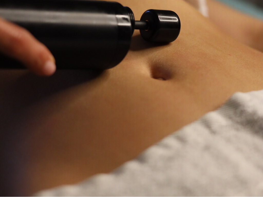 Вибровакуумтерапия «Стройное тело» на аппарате НАЛАР