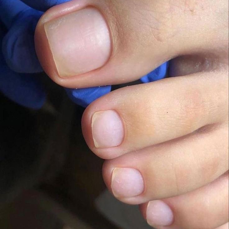 Снятие нашего материала на ногах (без дальнейшего покрытия)