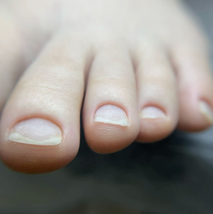 Снятие чужого материала на ногах (без дальнейшего покрытия)