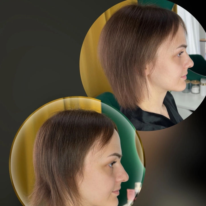 Прикорневой объем