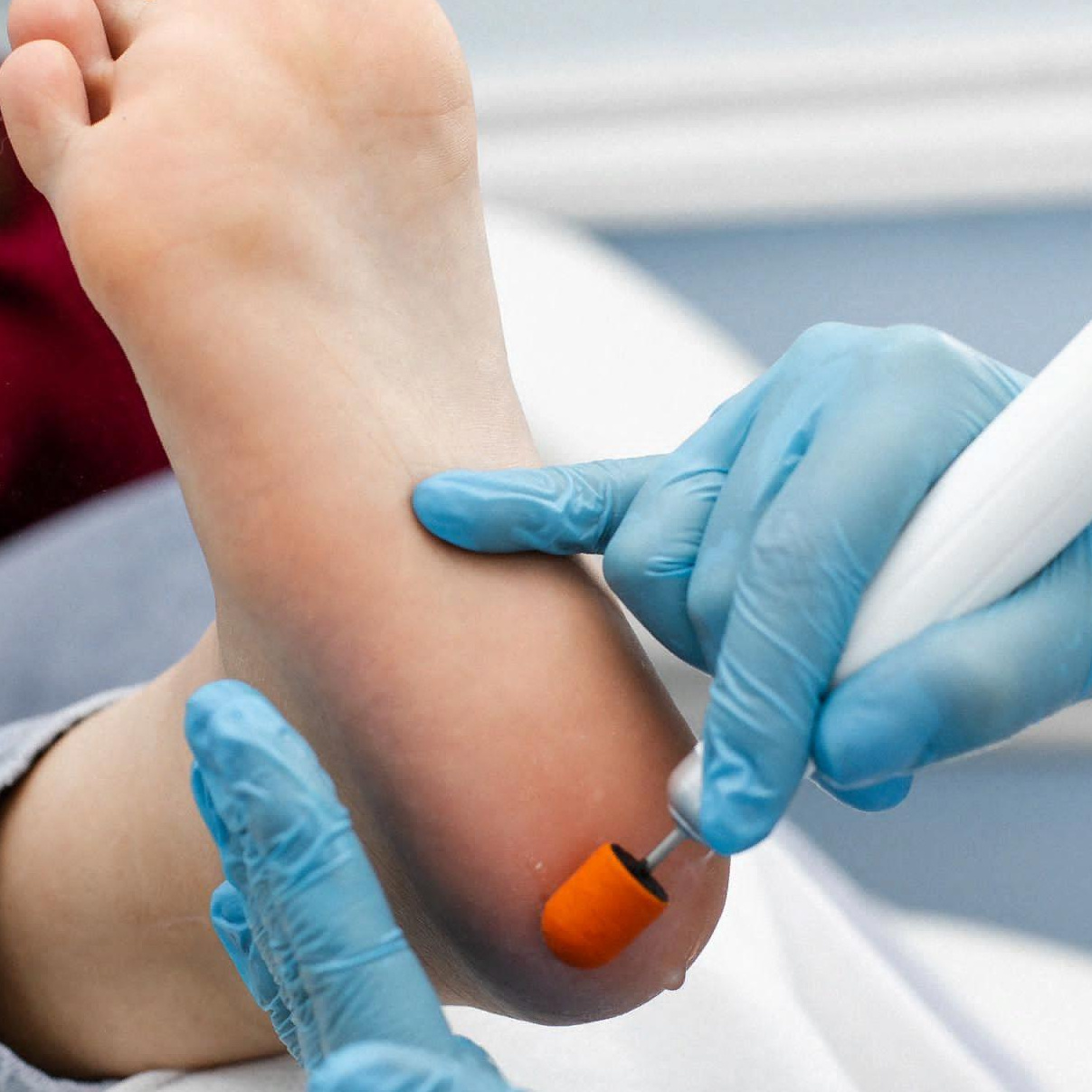 Обработка трещин на пятках