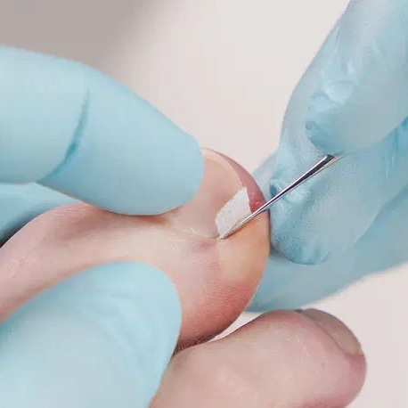 Установка тампонады