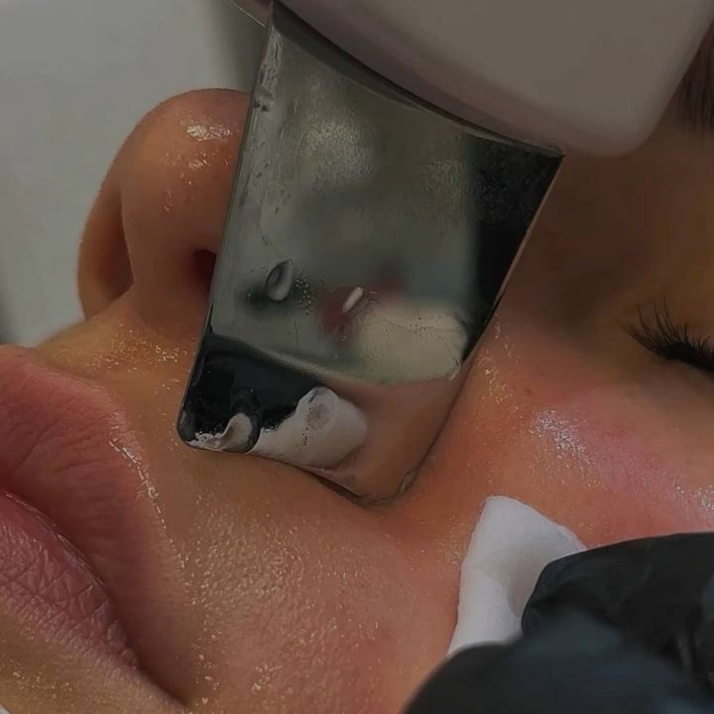 Ультразвуковая чистка лица