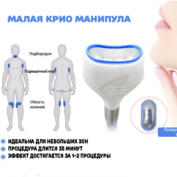 Криолиполиз (1 малая зона)