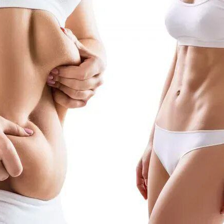 Комплекс Трио (криолиполиз 4 зоны+RF-лифтинг или кавитация+сфера)