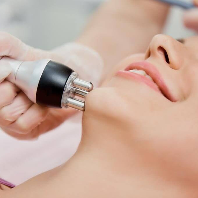 RF- лифтинг: лицо