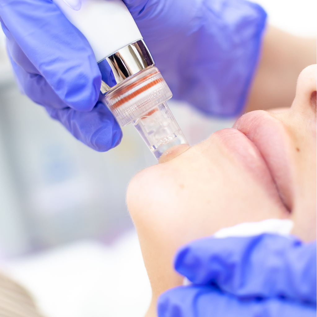 Гидропилинг - HYDRAFACIAL