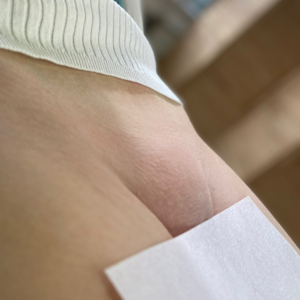 Шугаринг зоны Бикини глубокое