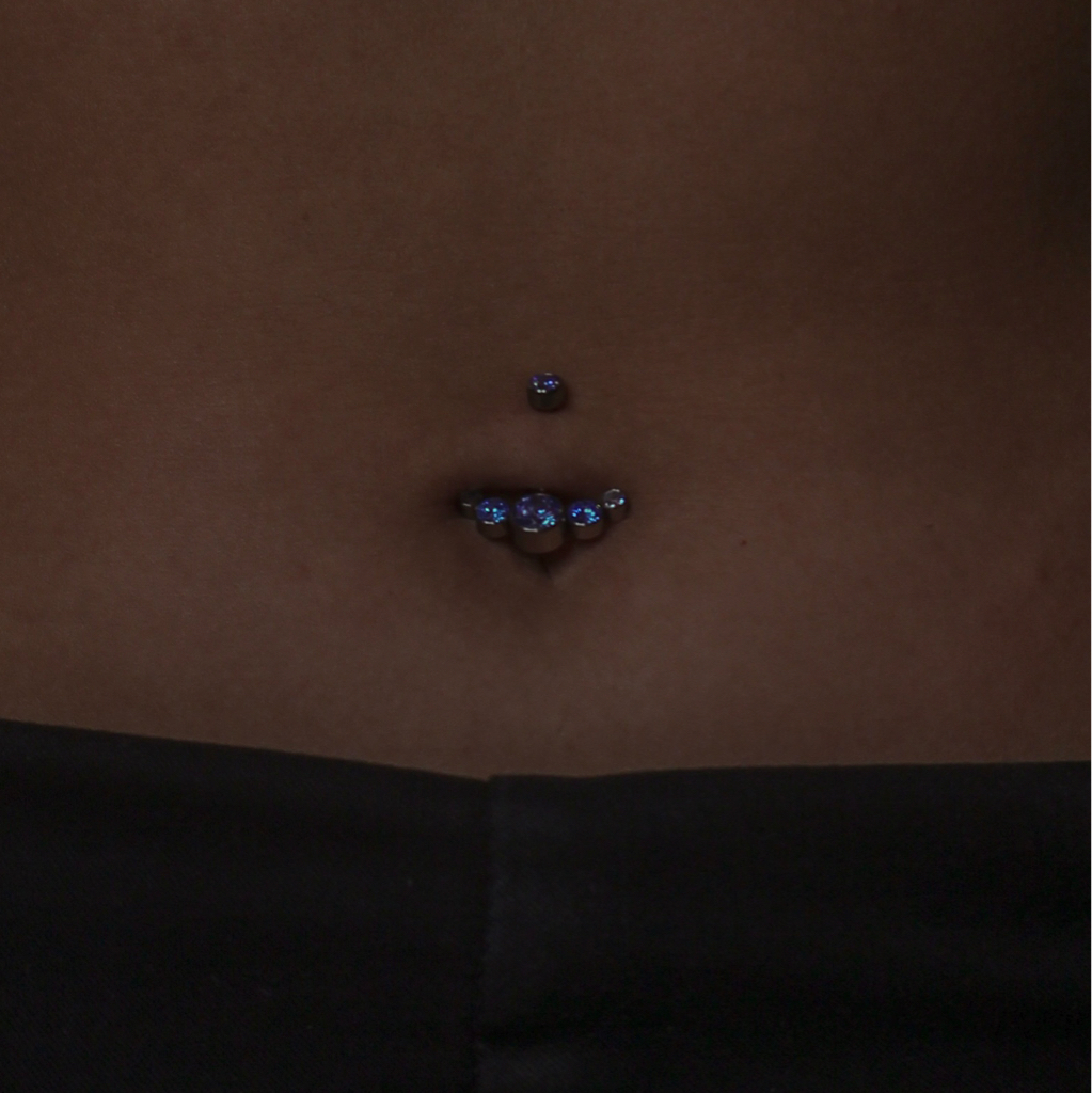 Прокол Пупка