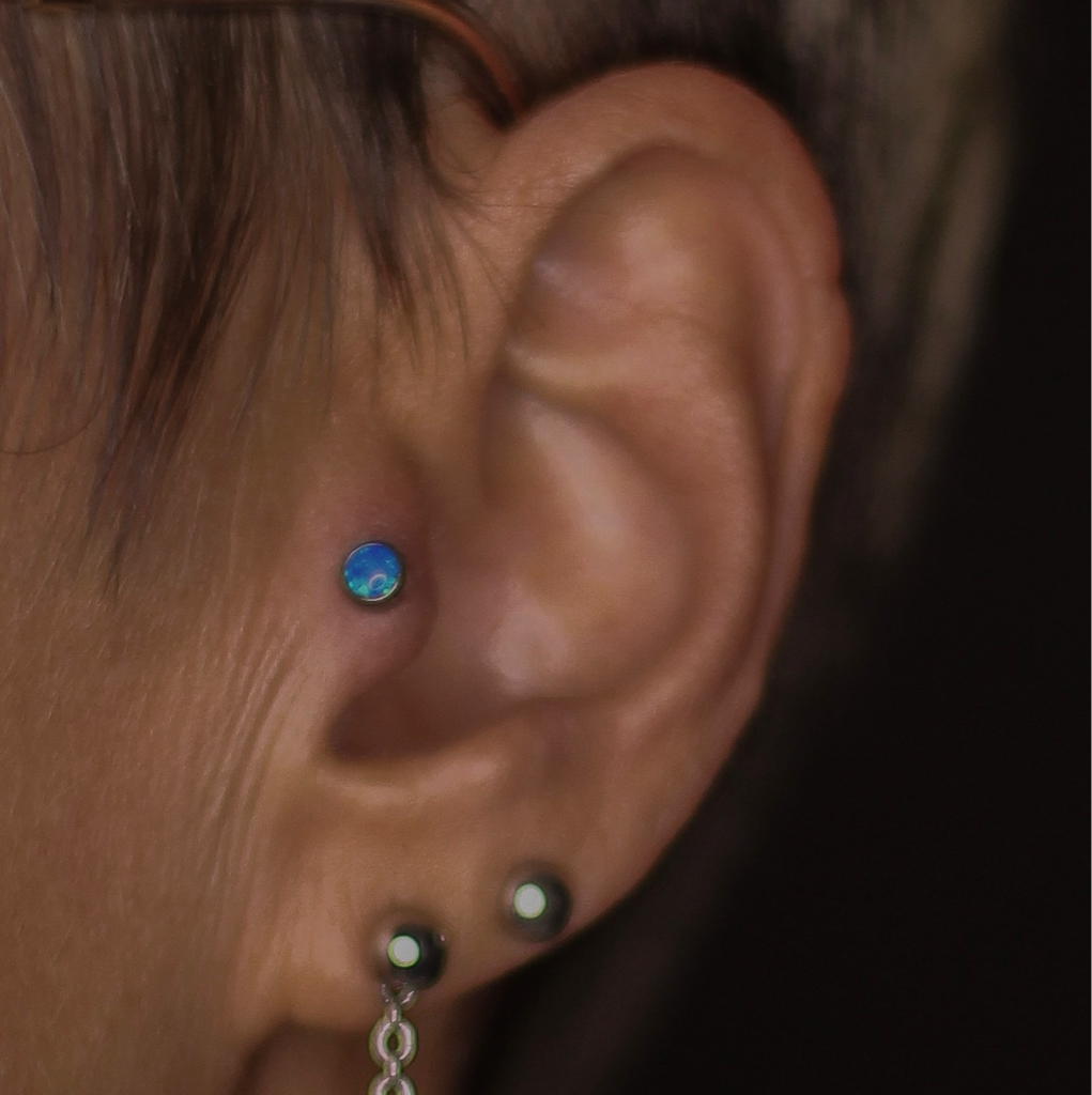 Прокол Трагус