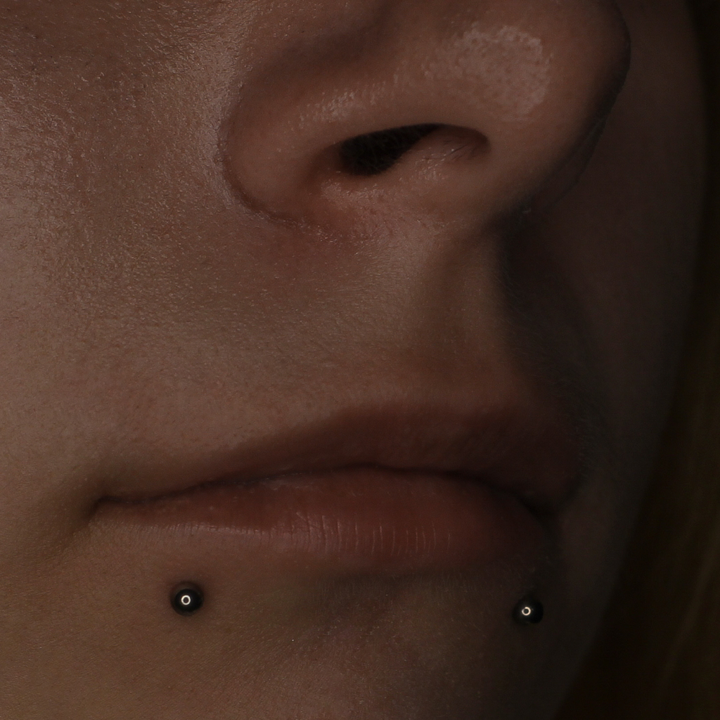 Прокол Укус змеи