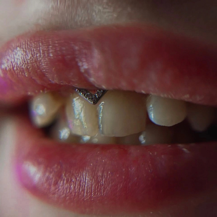 Прокол смайл