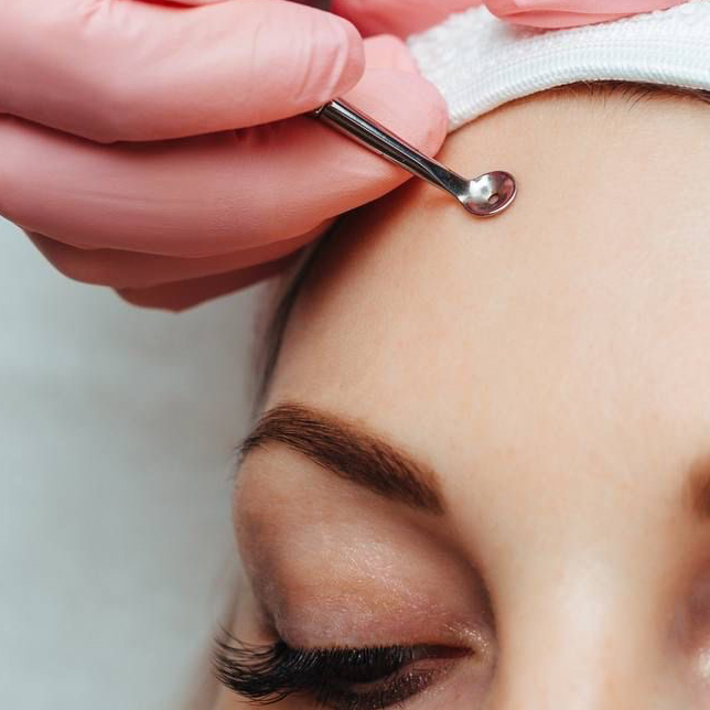 Механическая чистка