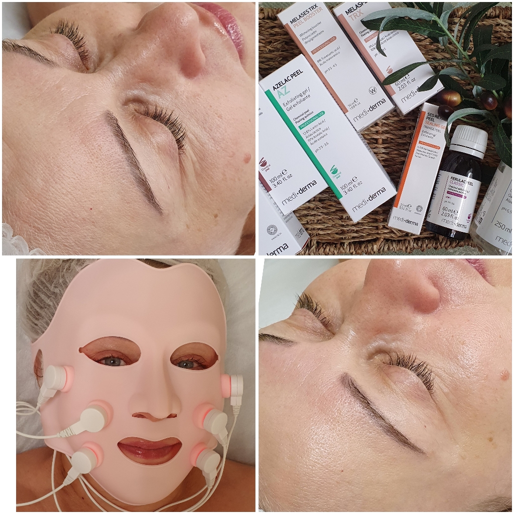 Новая жизнь кожи (пилинги+ретинол)