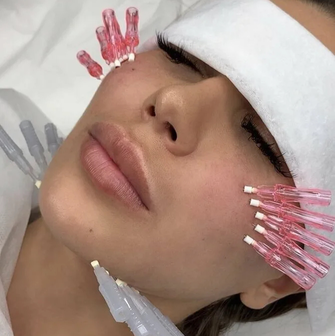 Тредлифтинг