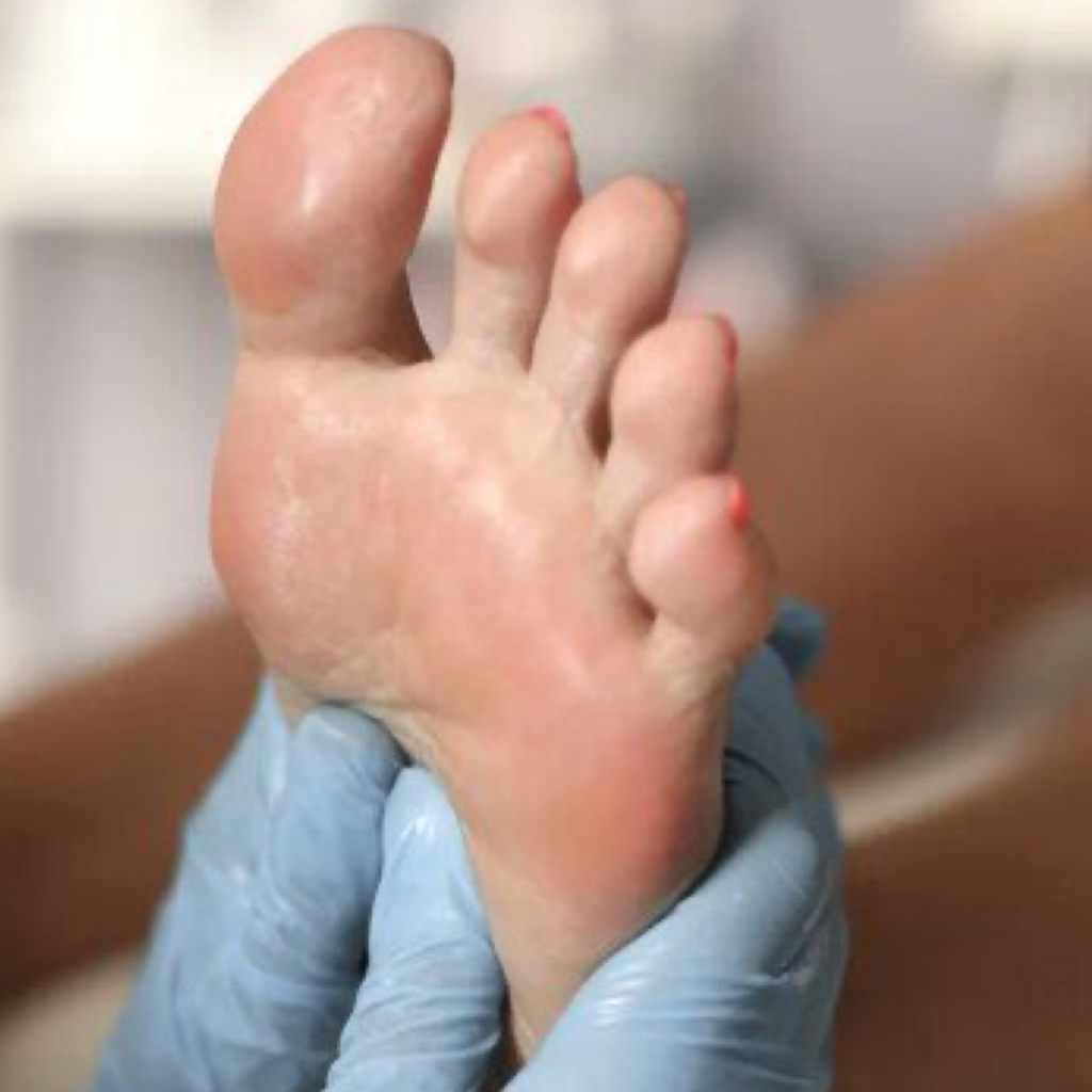 консультация подолога