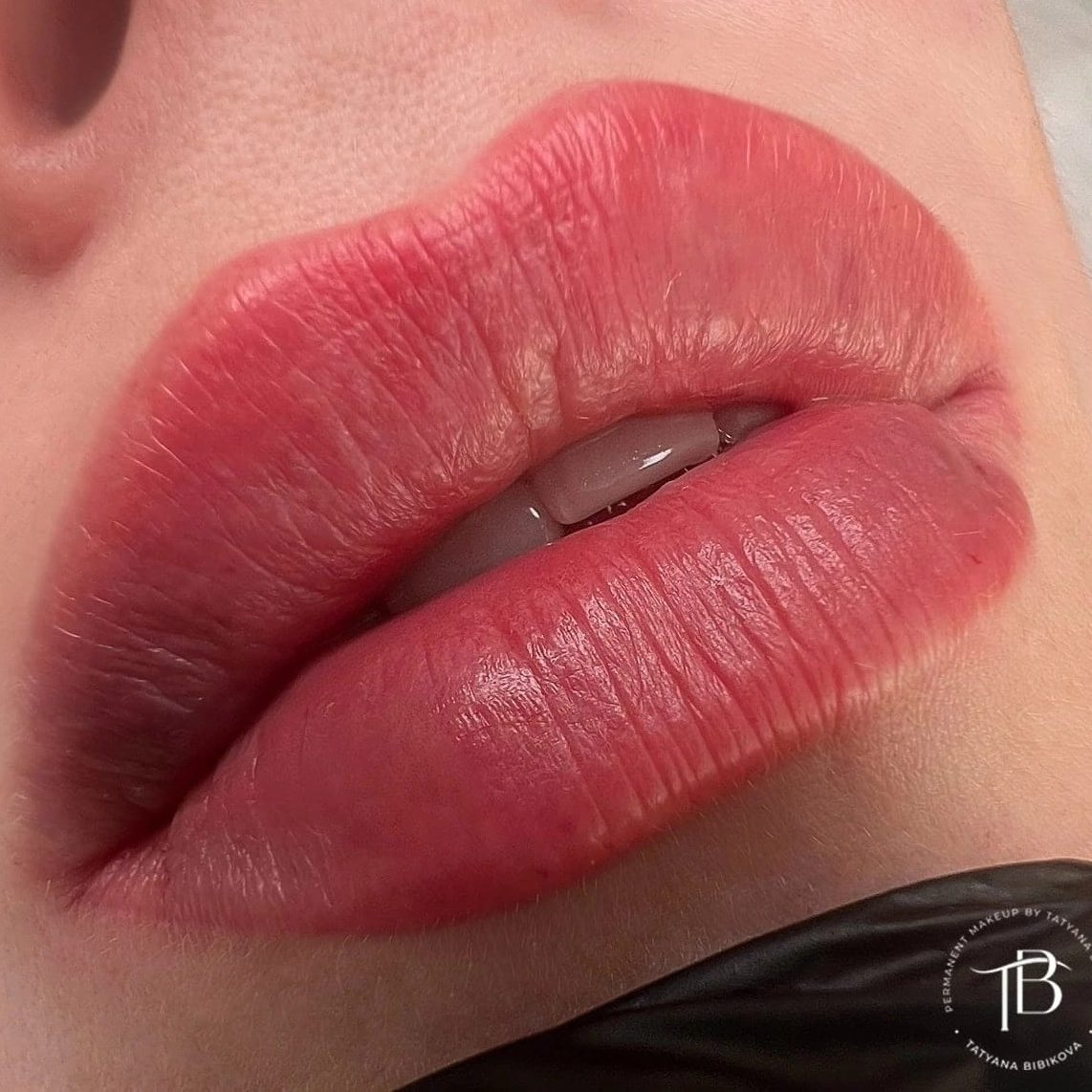 ПМ губы (коррекция)
не позже 4 месяцев от процедуры