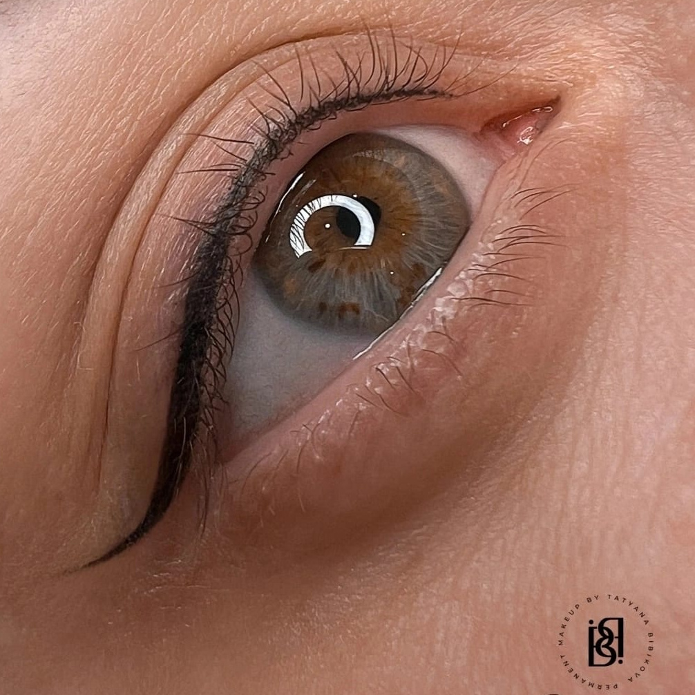 ПМ Стрелка классич.(коррекция)
не позже 4 месяцев от процедуры