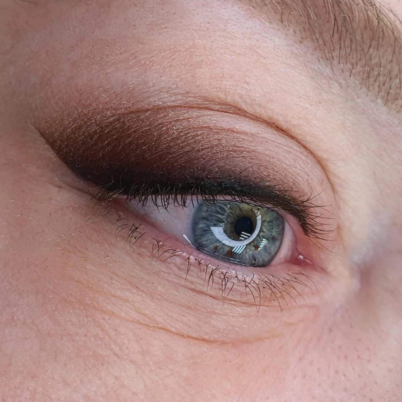 ПМ стрелка с раст.(коррекция)
не позже 4 месяцев от процедуры