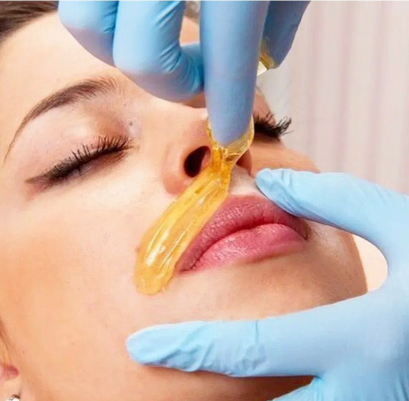 Эпиляция воском подбородок