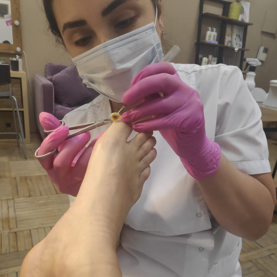 Педикюр парамедицинский