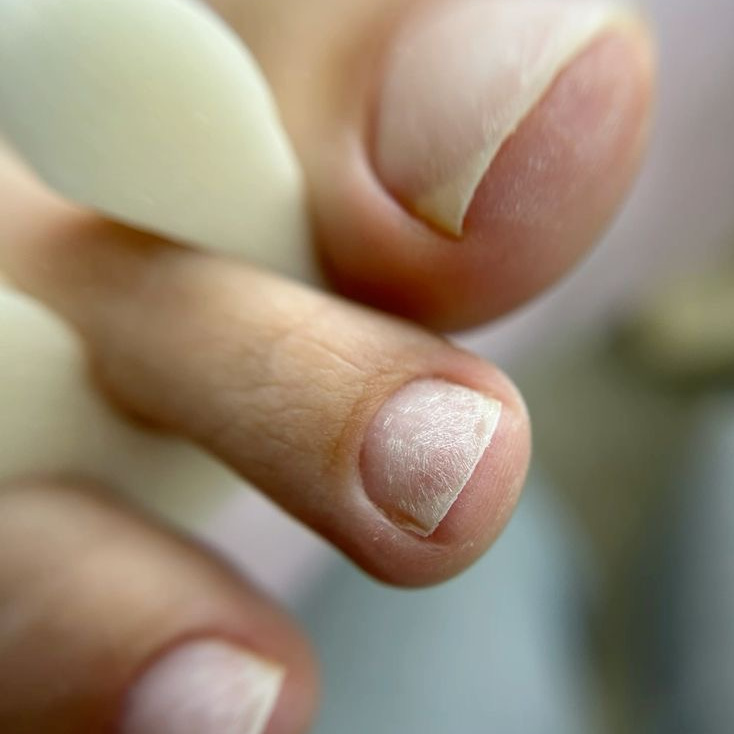 Педикюр гигиенический