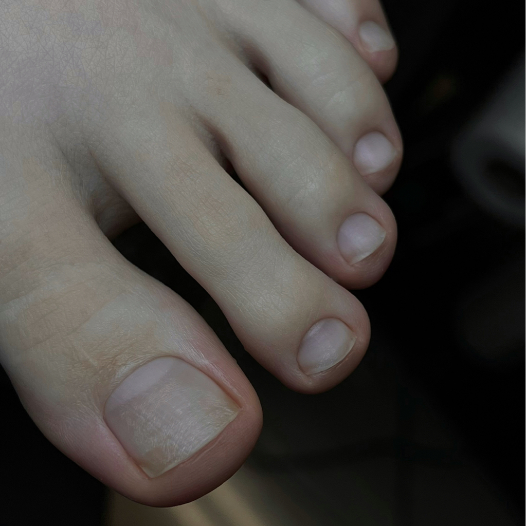 Пальчики без покрытия