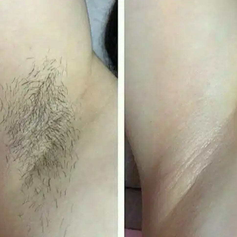 Подмышечные впадины