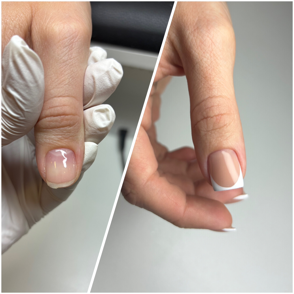 Сложная коррекция