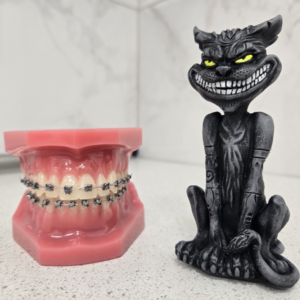 Детская коррекция брекетов