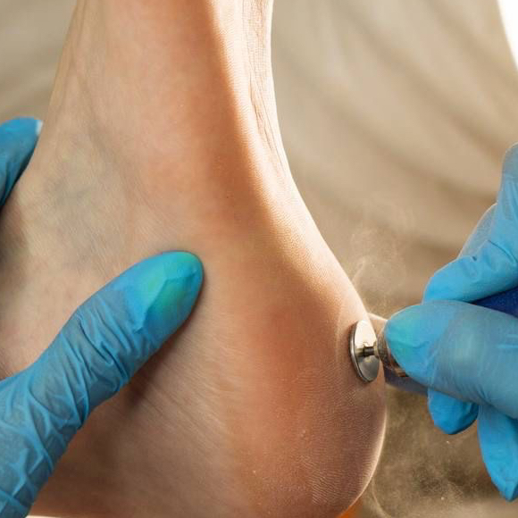 Обработка ступней