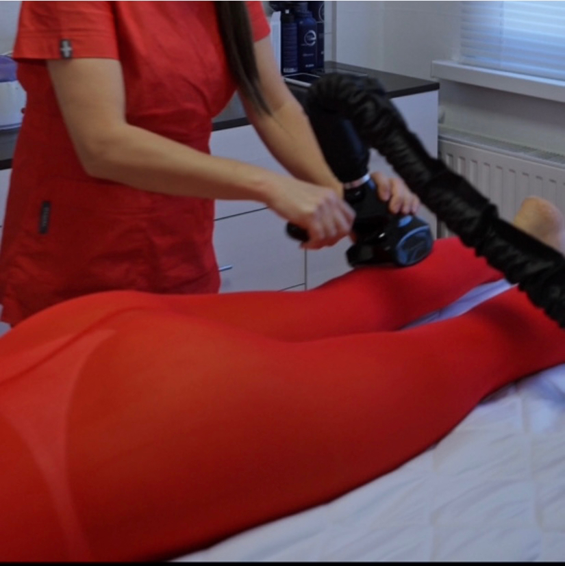 LPG массаж тела 45 минут, разовое посещение